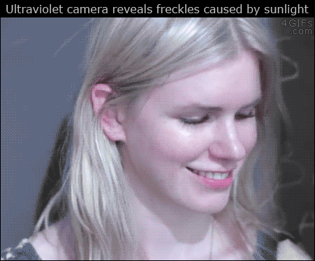 Ultraviolet-camera-freckles-sunlight